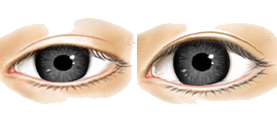 Real Eye PNG Clipart PNG, SVG Clip art for Web - Download Clip Art, PNG
